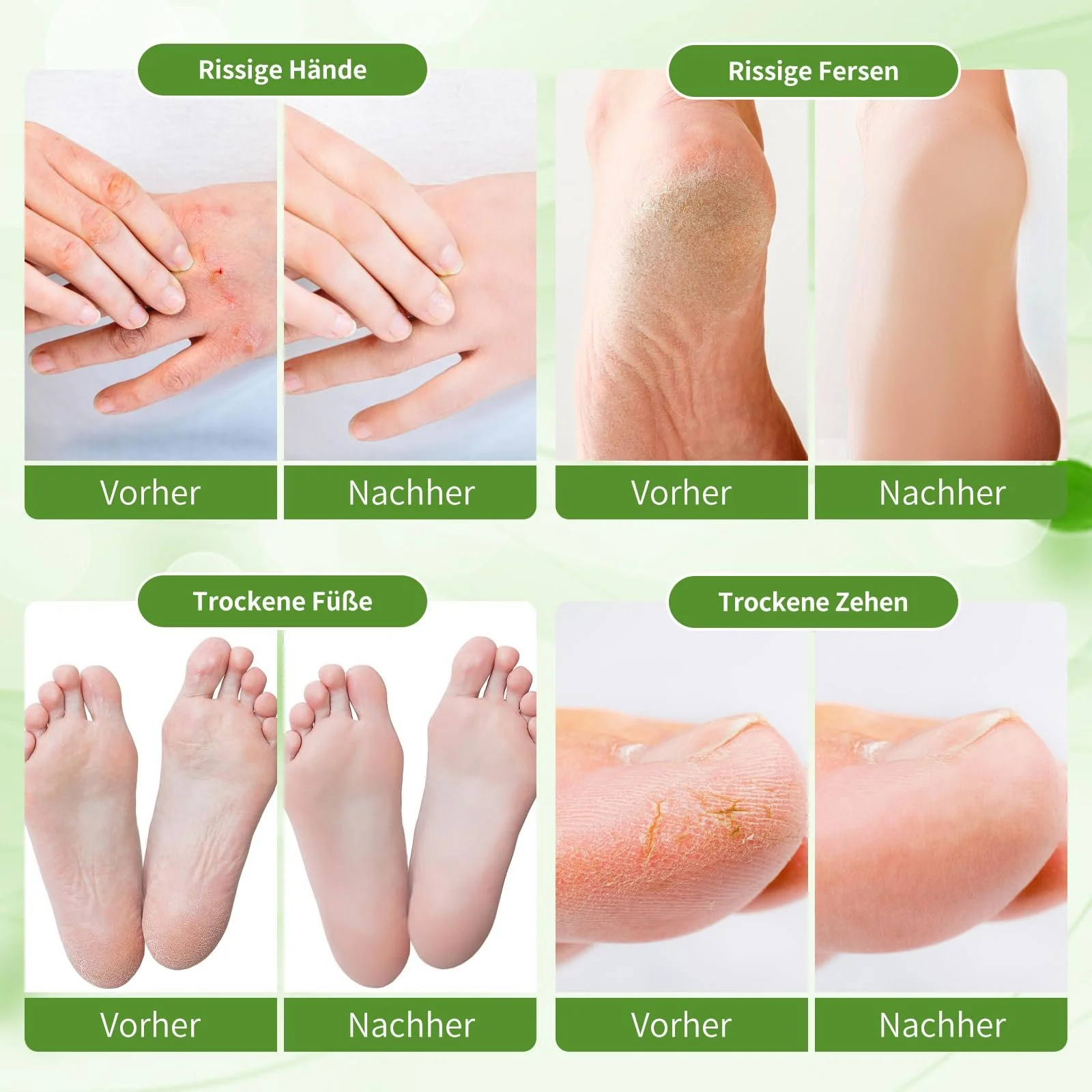 Крем для ухода за ногами Callus Remover Deep Moisture and Softening 80 мл Jasmine, фото №4