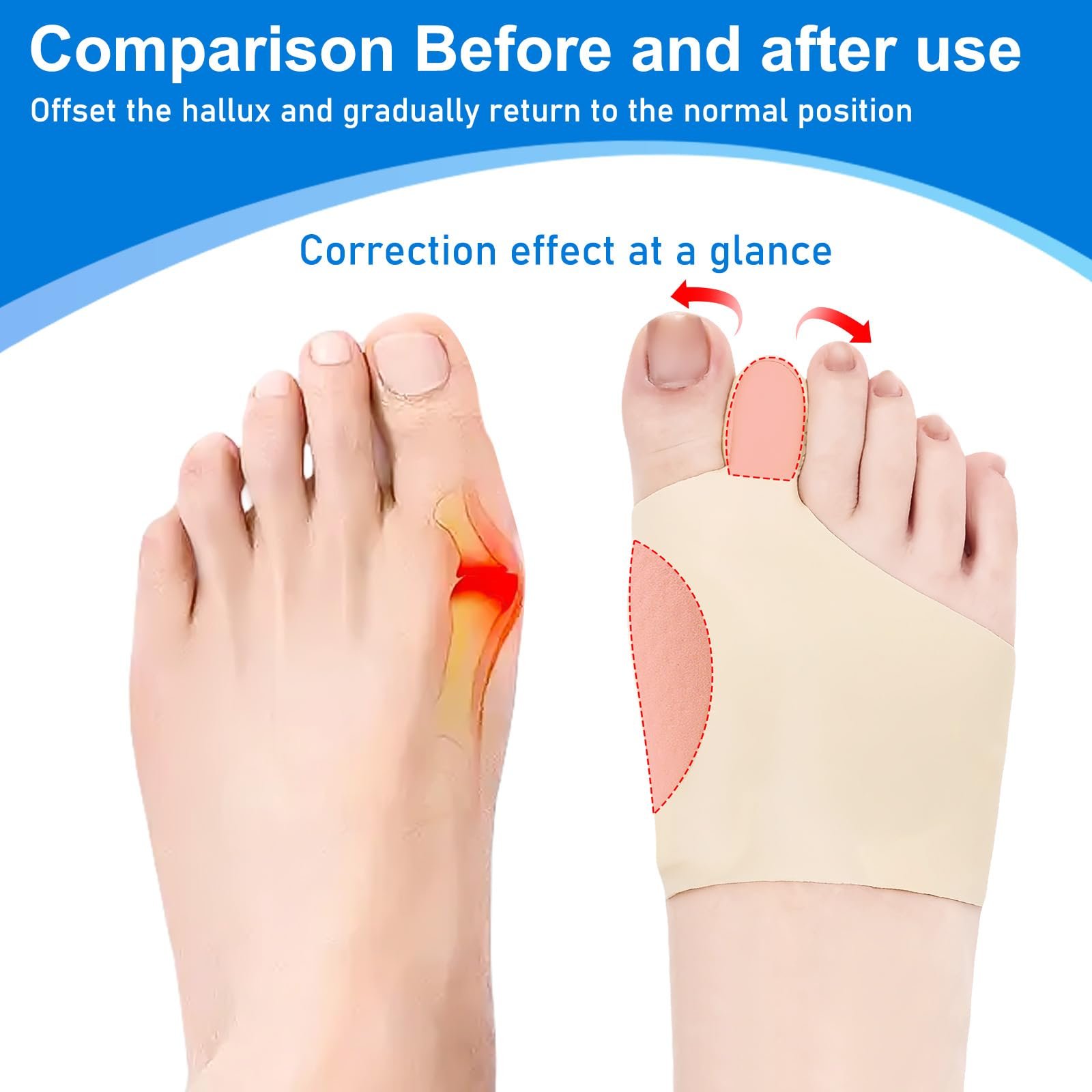 Пов'язка для захисту від Hallux Valgus (2 пари), роздільник для пальців, фото №3 Пов'язка для захисту від Hallux Valgus (2 пари), роздільник для пальців, фото №3