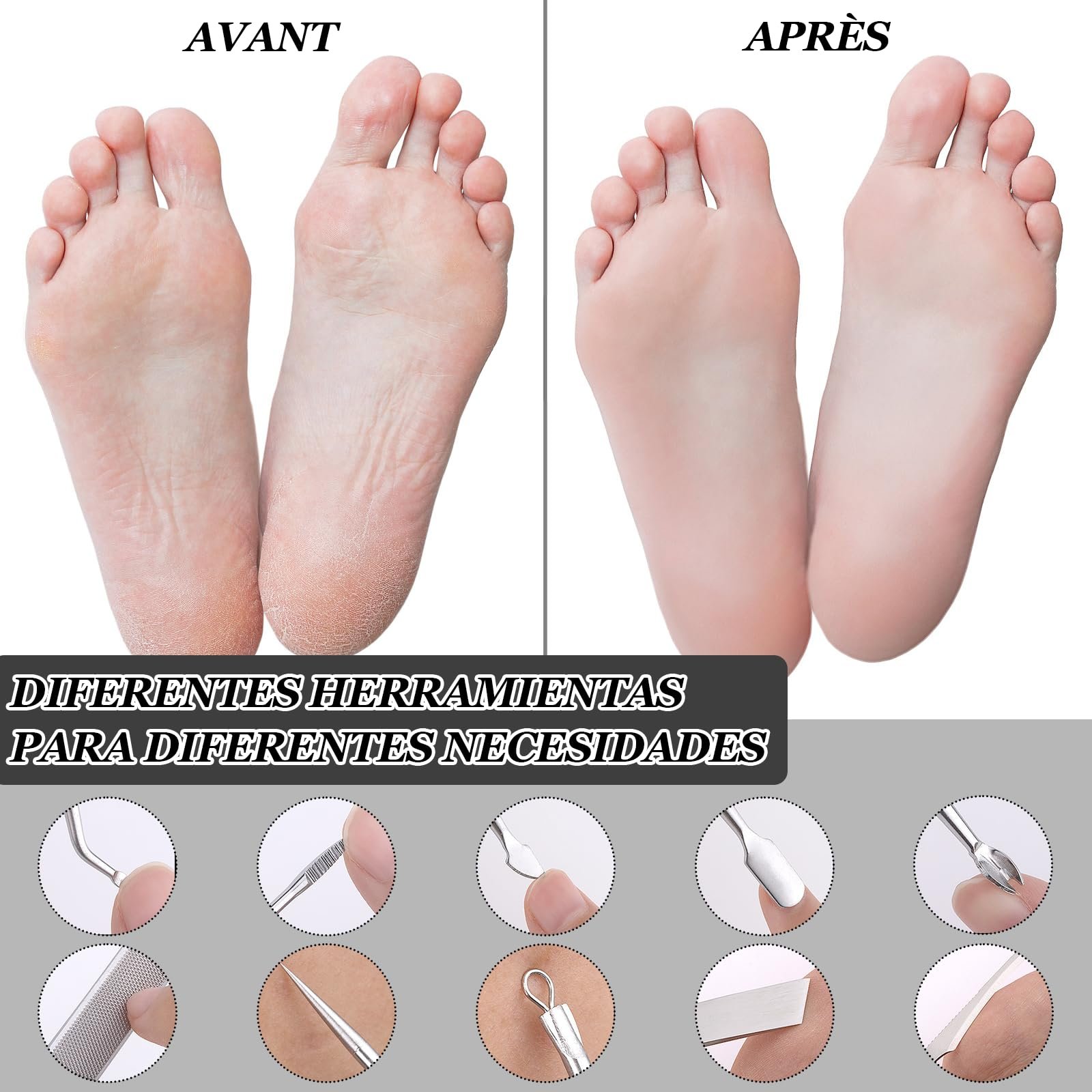 Набір для педикюру SPOKKI 9 шт., фото №4 Набір для педикюру SPOKKI 9 шт., фото №4