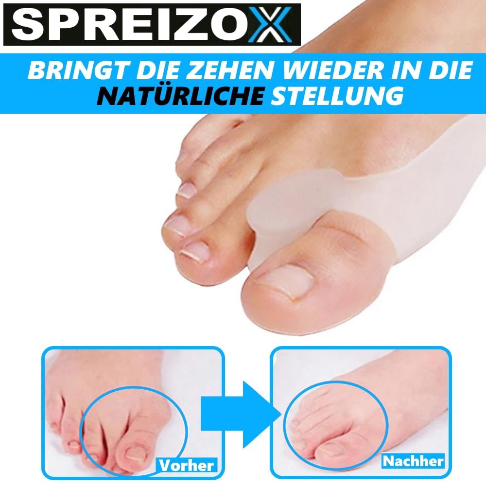 Роздільник для пальців ніг SPREIZOX Захист від вальгусної деформації стопи Силіконовий Hallux Valgus, [Упаковка з 6 штук], фото №3