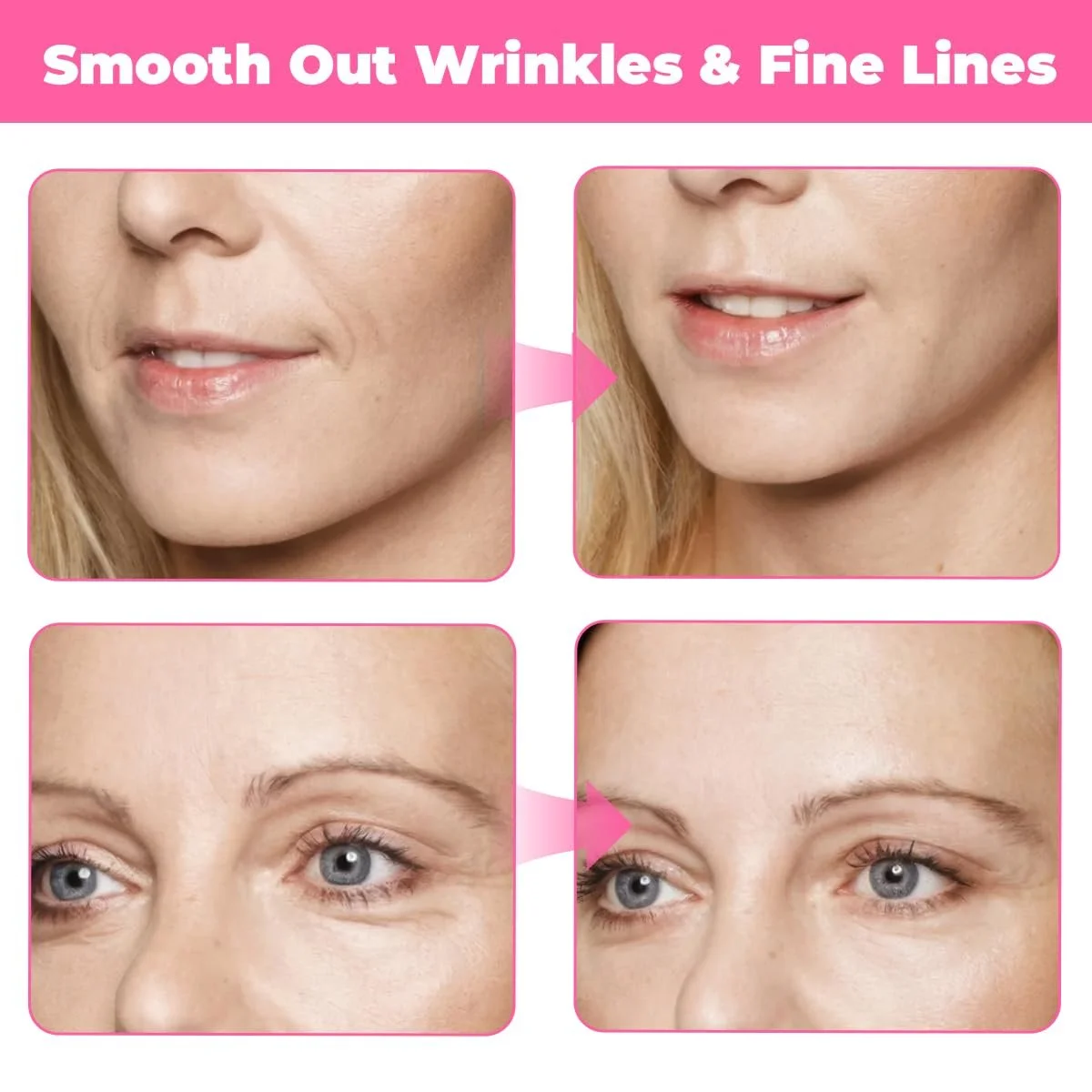 Тейп для підтяжки обличчя 4 шт. 2,5 см x 5 м для контурування обличчя, фото №6