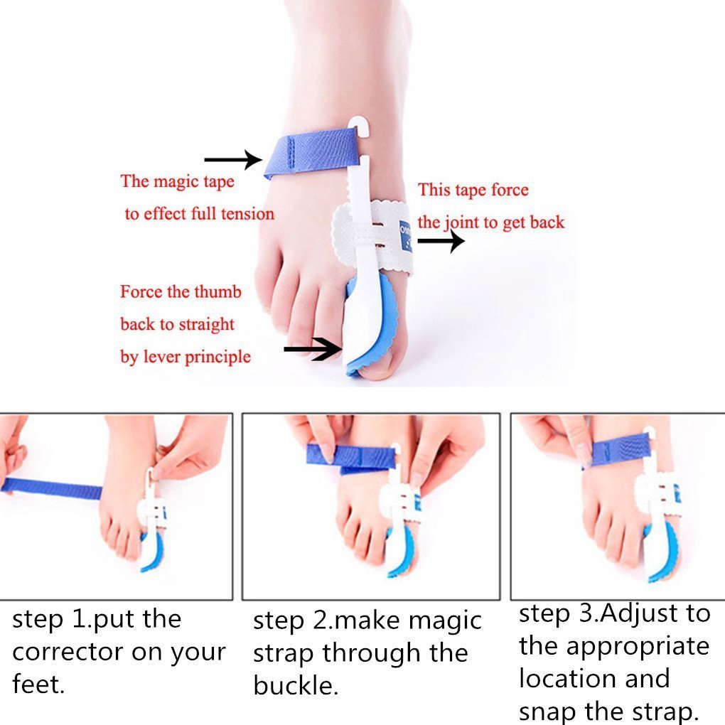 Коректор великого пальця стопи 2 пари, фото №2