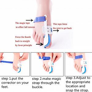 Коректор великого пальця стопи 2 пари synthetic.ua - Фото 1