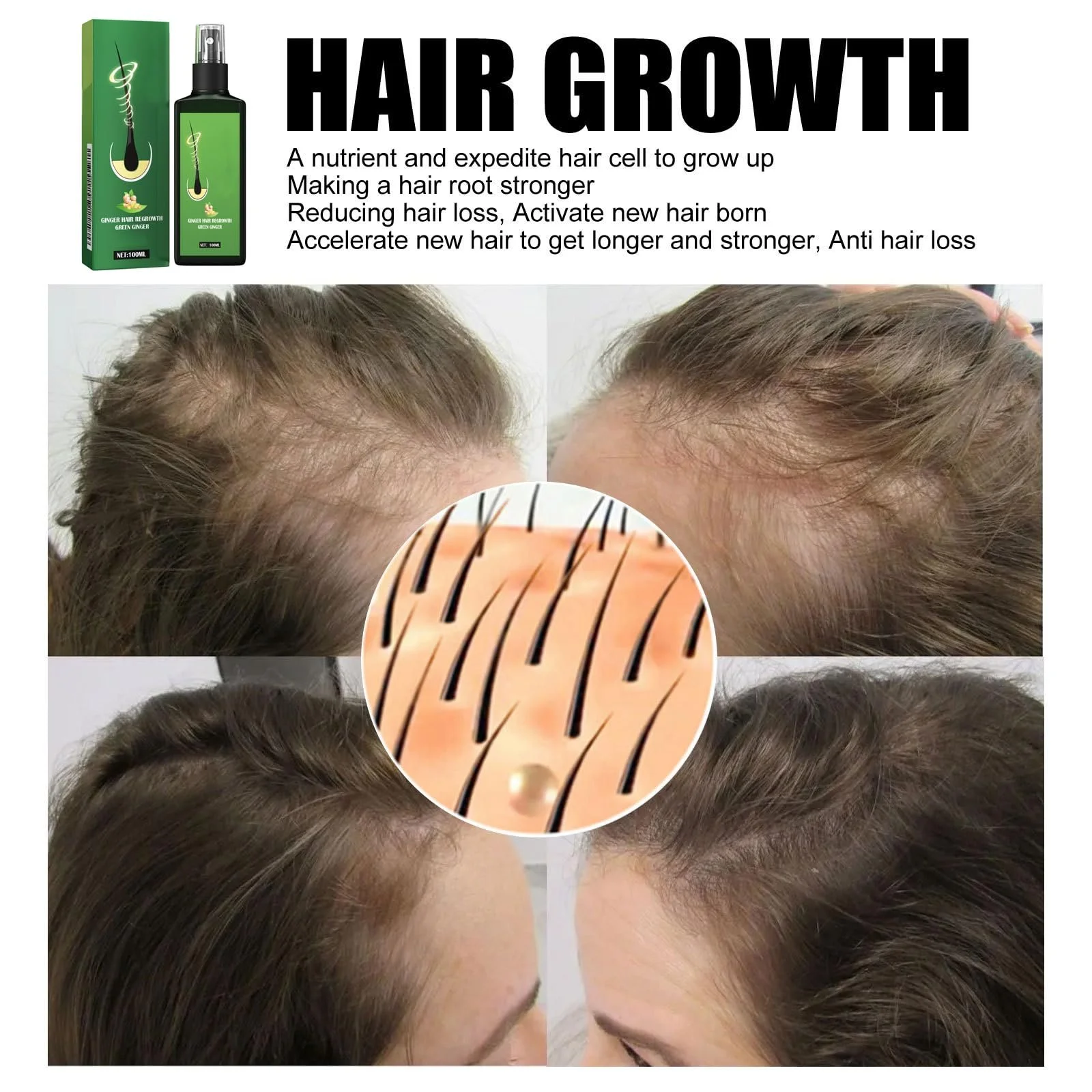 Кондиционер для волос Eazerom 13, фото №4