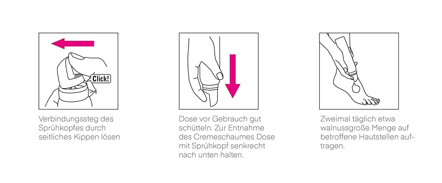 Крем-пена для ног Callusan Extra 10% Urea 125 мл, фото №5