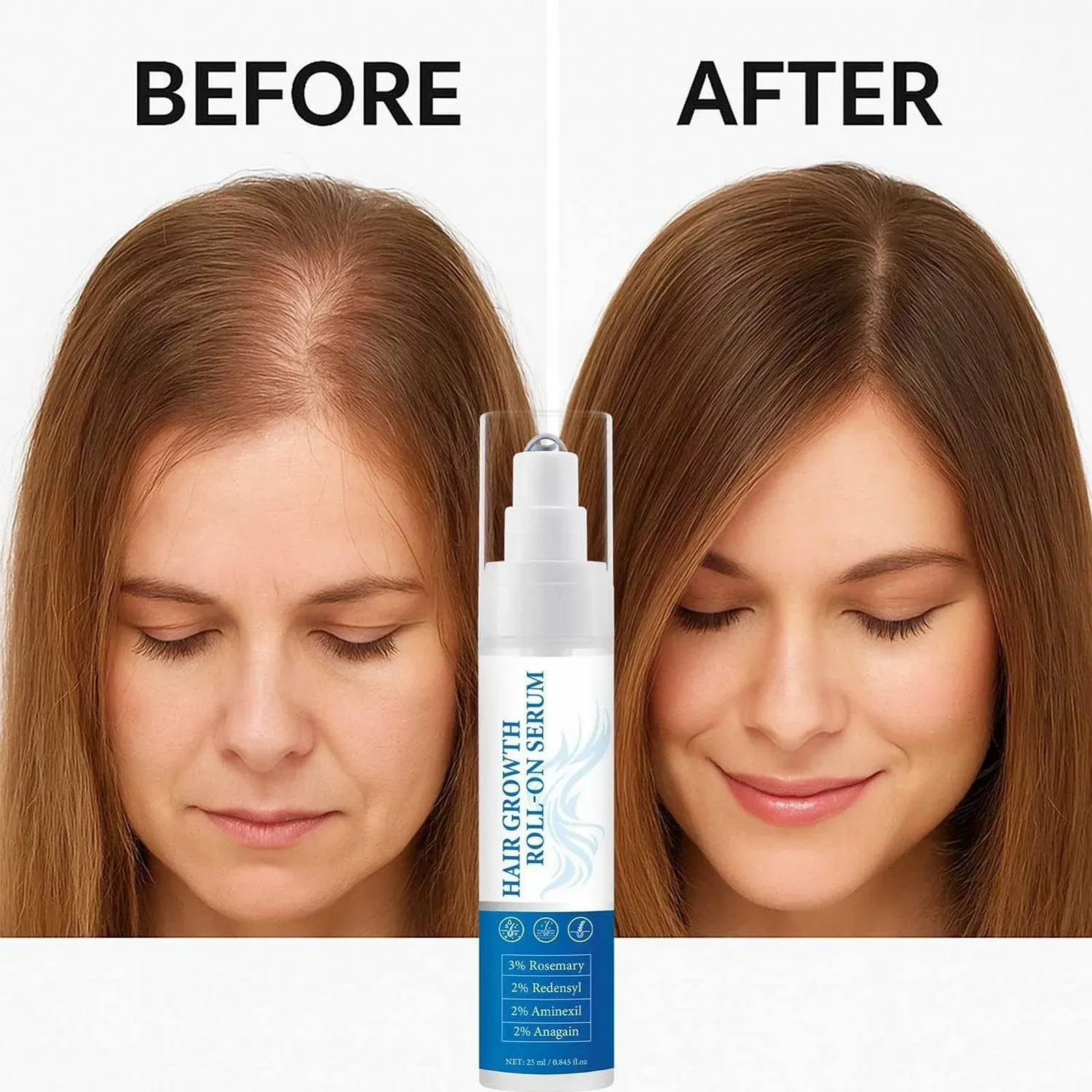 Засіб для росту волосся Yuecjian для чоловіків та жінок, розчин для відновлення шкіри голови, 25 мл, фото №5