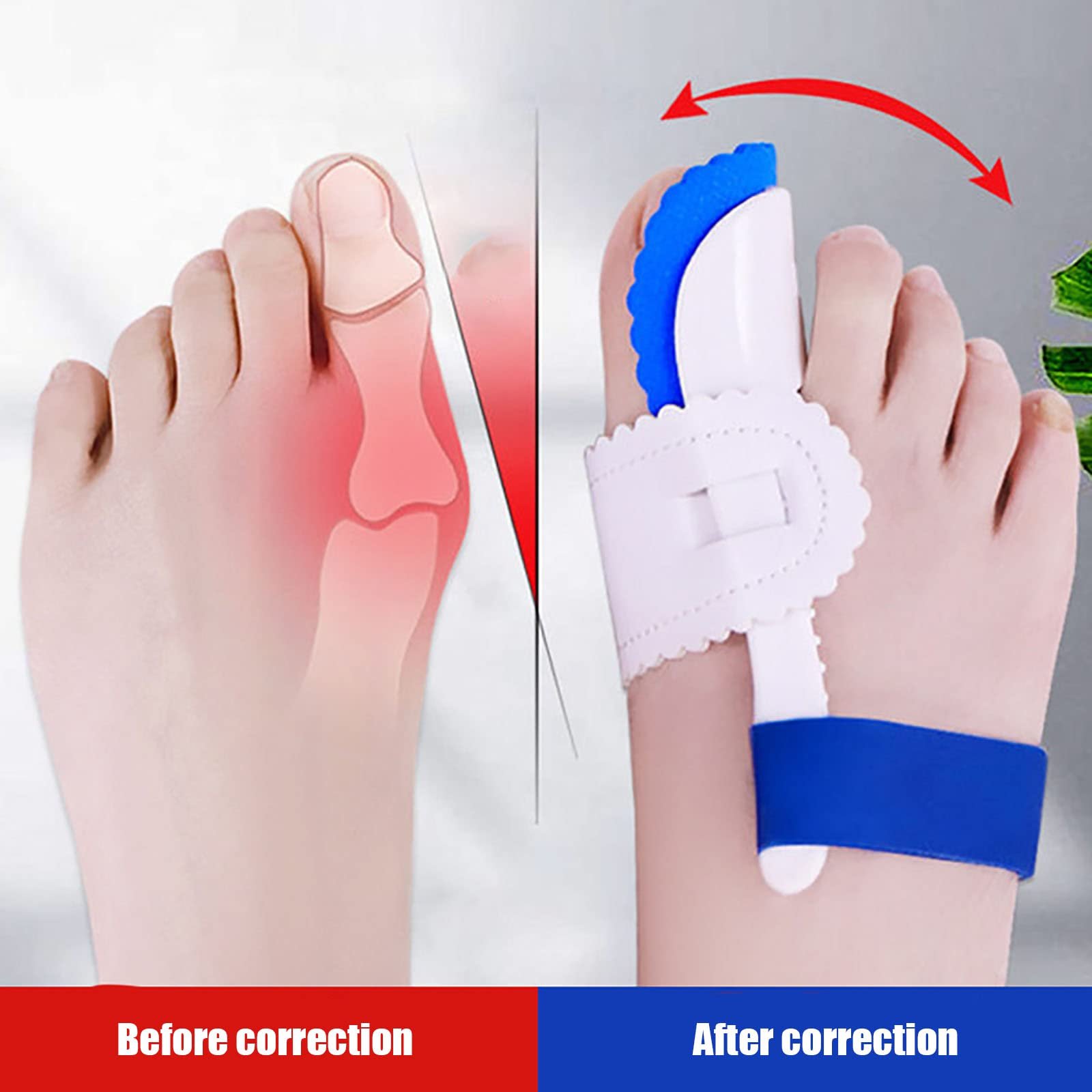 Коректор Вальгусної Деформації для Жінок та Чоловіків Ортопедичний Синій, фото №3
