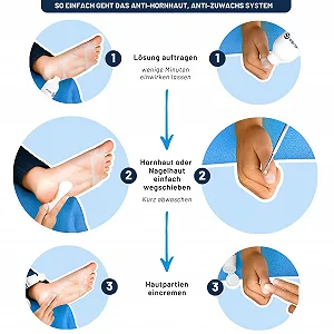 Набор для ухода за руками и ногами Mr. Fuss № 4 Advanced Pack для удаления мозолей и кутикулы 4 предмета synthetic.ua - Фото 1