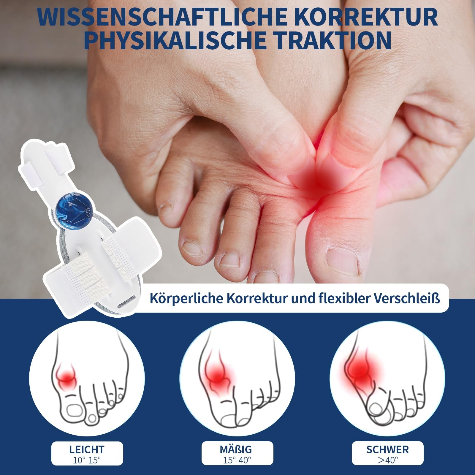 Корректор большого пальца стопы Hallux Valgus, Унисекс, Фиксирующая пластина с силиконовым разделителем, фото №6 Корректор большого пальца стопы Hallux Valgus, Унисекс, Фиксирующая пластина с силиконовым разделителем, фото №6