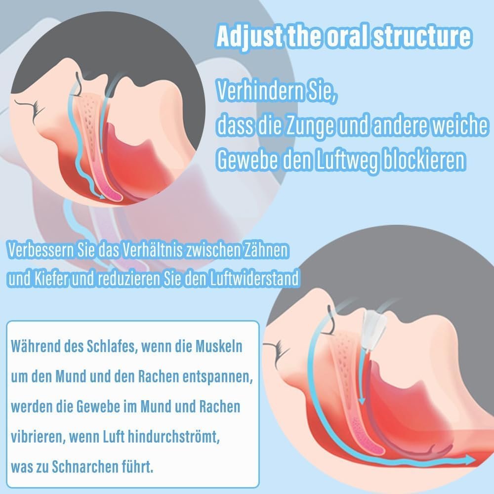 Засіб від хропіння, 2 шт, Шина, фото №5 Засіб від хропіння, 2 шт, Шина, фото №5