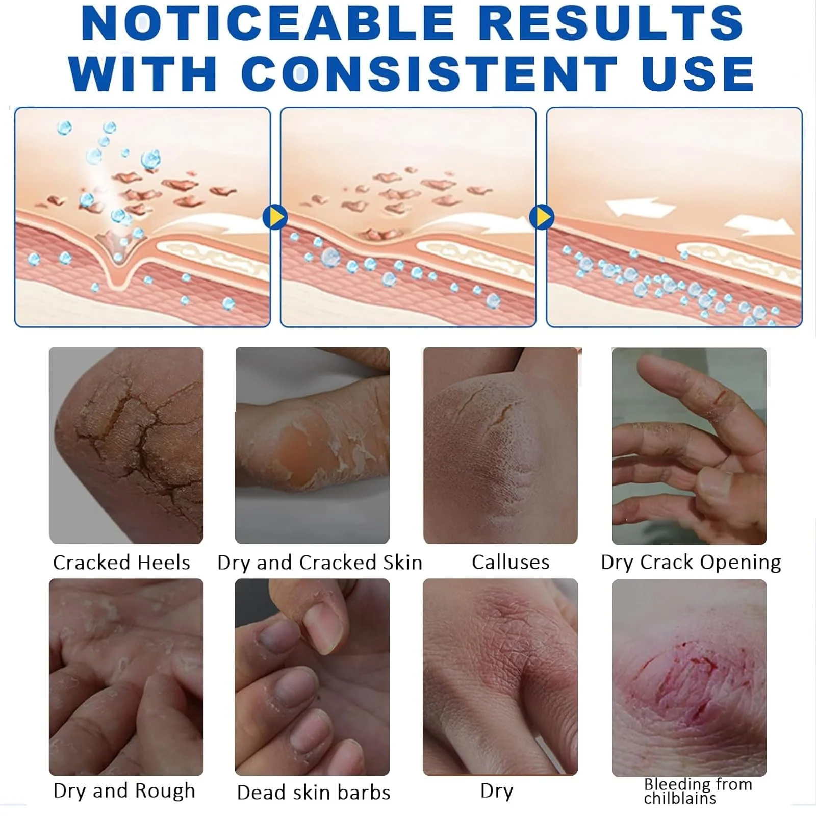 Восстанавливающий крем для ног и рук 60% Urea Cream с пилкой для стоп, фото №5