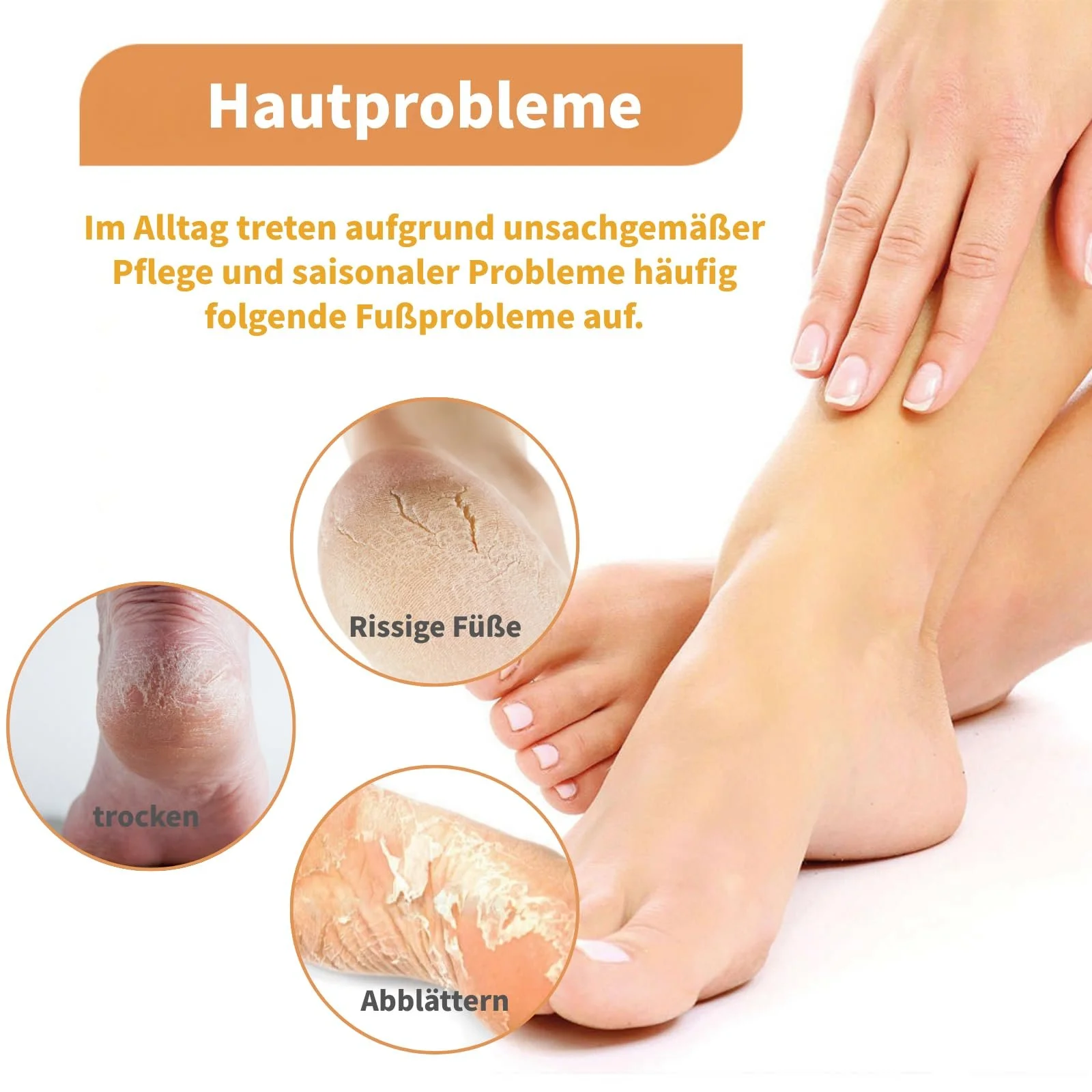 Крем для ног Urea 60% увлажняющий против трещин 2 шт., фото №6 Крем для ног Urea 60% увлажняющий против трещин 2 шт., фото №6