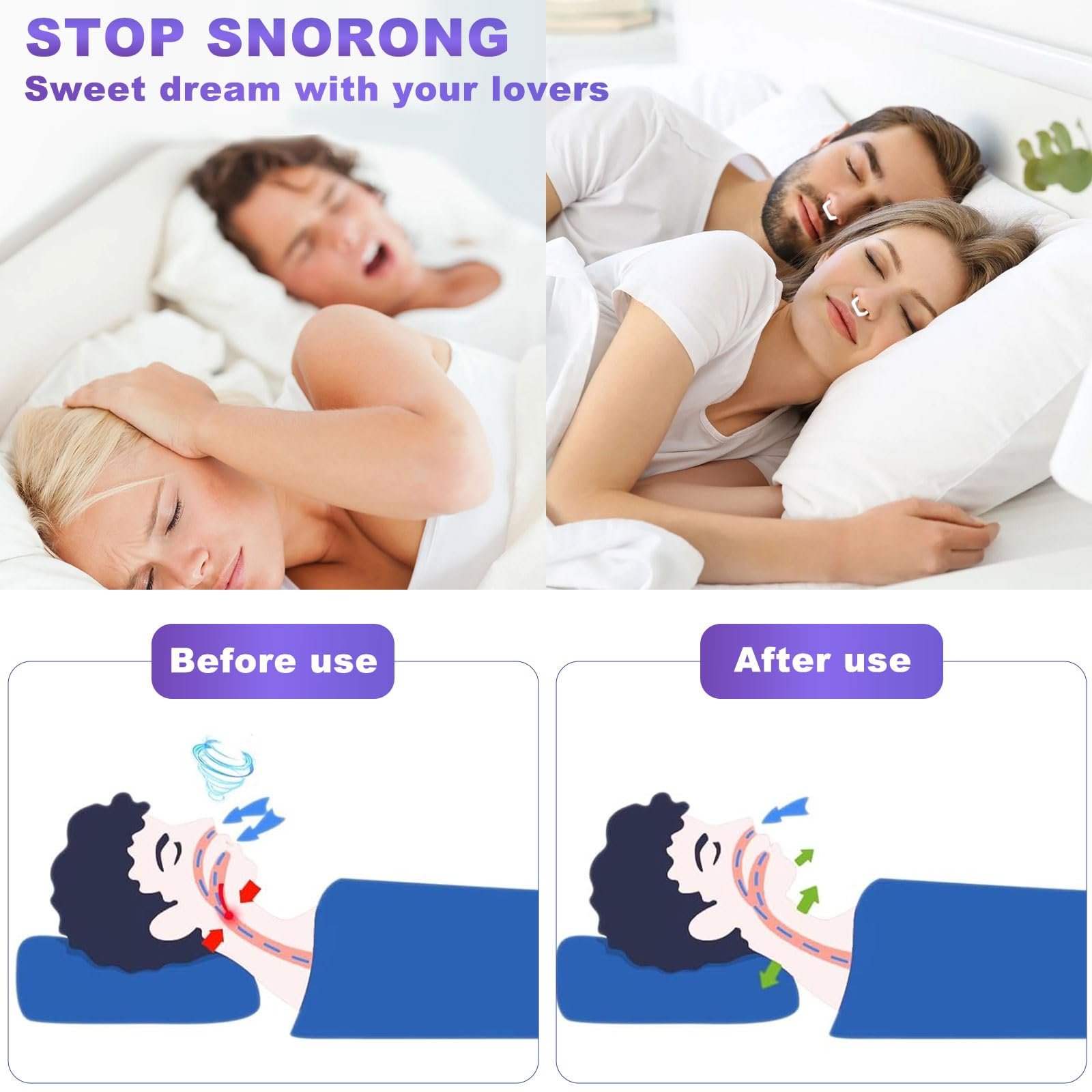 Затискачі від хропіння Srup, 8 шт., затискач для носа, роздільник для носа, фото №6 Затискачі від хропіння Srup, 8 шт., затискач для носа, роздільник для носа, фото №6