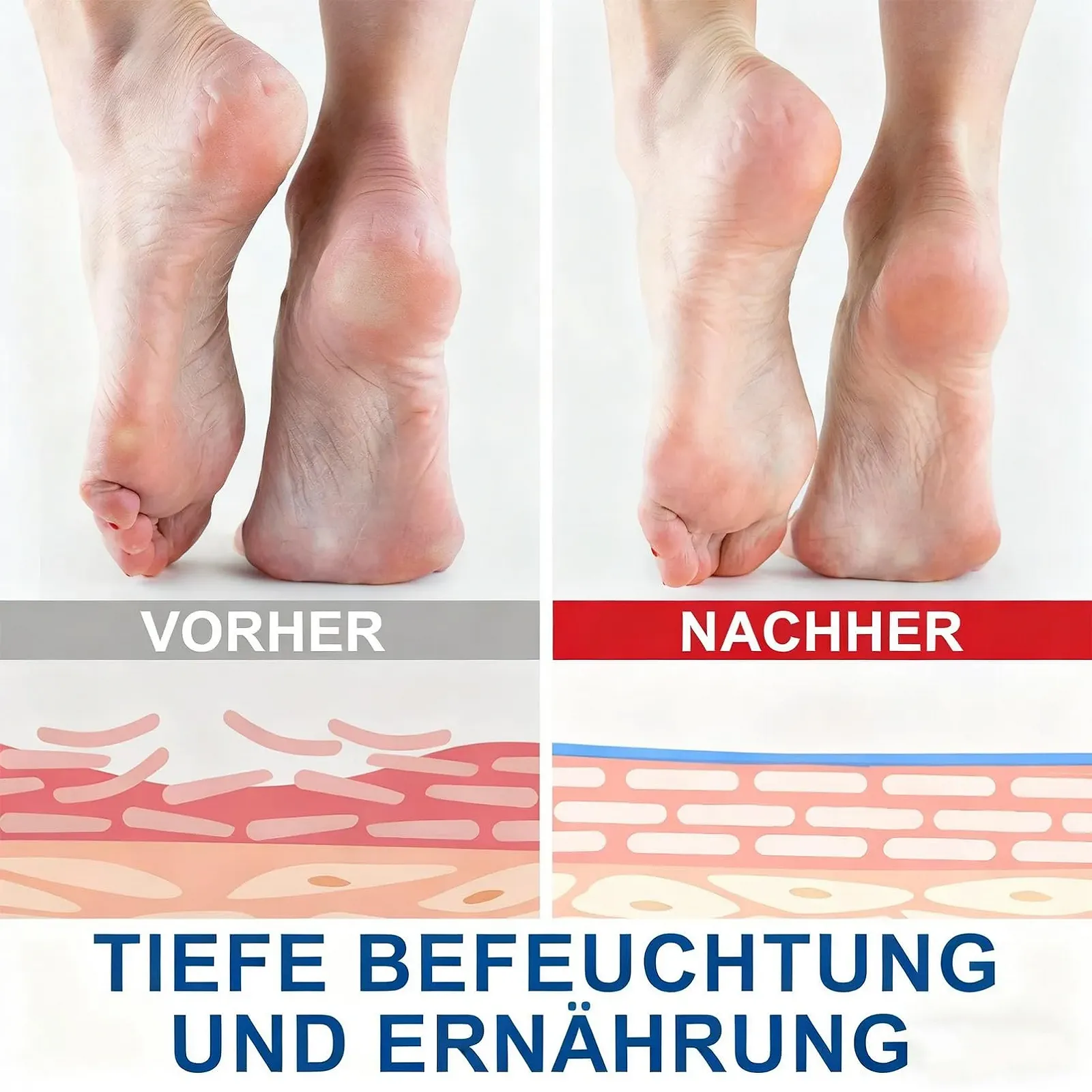 Крем-стик для ног Urea Cream 60% увлажняющий против трещин 2 шт., фото №5 Крем-стик для ног Urea Cream 60% увлажняющий против трещин 2 шт., фото №5