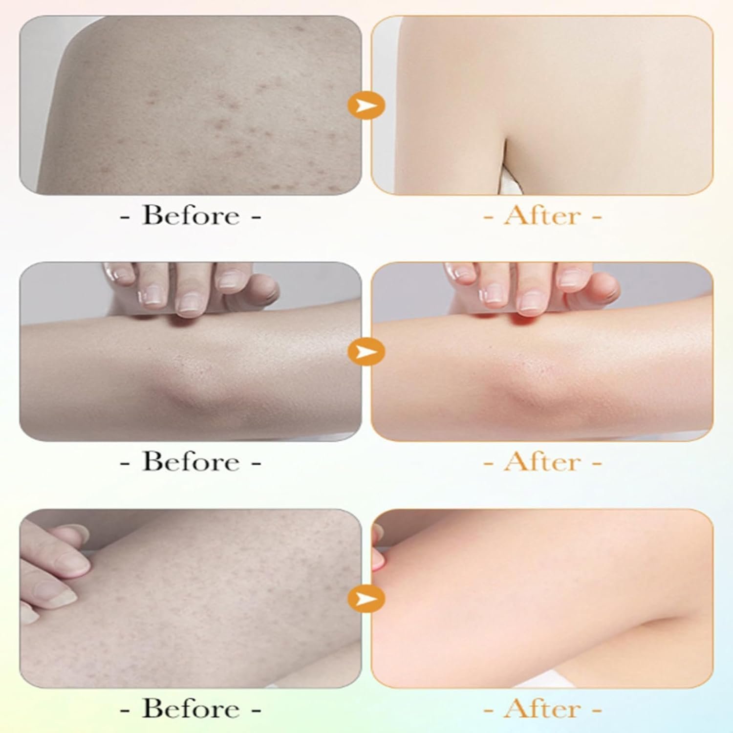 Гель для душу Vitamin C and Lemon Niacinamide Відлущувальний Глибоке очищення, фото №6 Гель для душу Vitamin C and Lemon Niacinamide Відлущувальний Глибоке очищення, фото №6