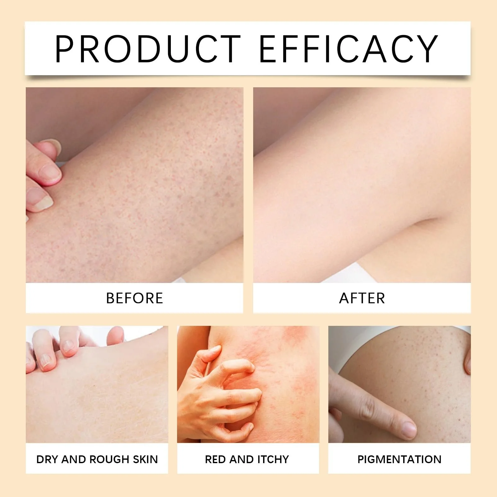 Лосьйон для тіла 150 мл, Відбілюючий крем для тіла, Заспокійливий лосьйон, фото №4 Лосьйон для тіла 150 мл, Відбілюючий крем для тіла, Заспокійливий лосьйон, фото №4