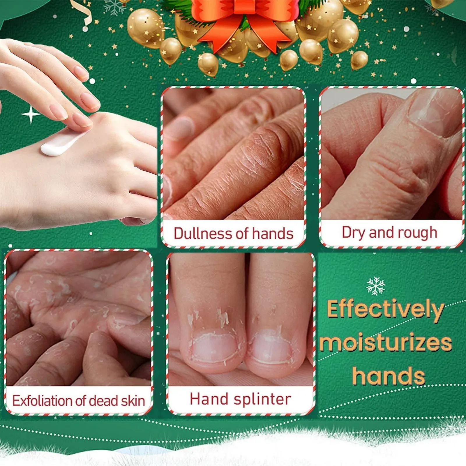 Набор кремов для рук 5 шт. Рождественский - для очень сухой потрескавшейся кожи рук и ног, фото №3