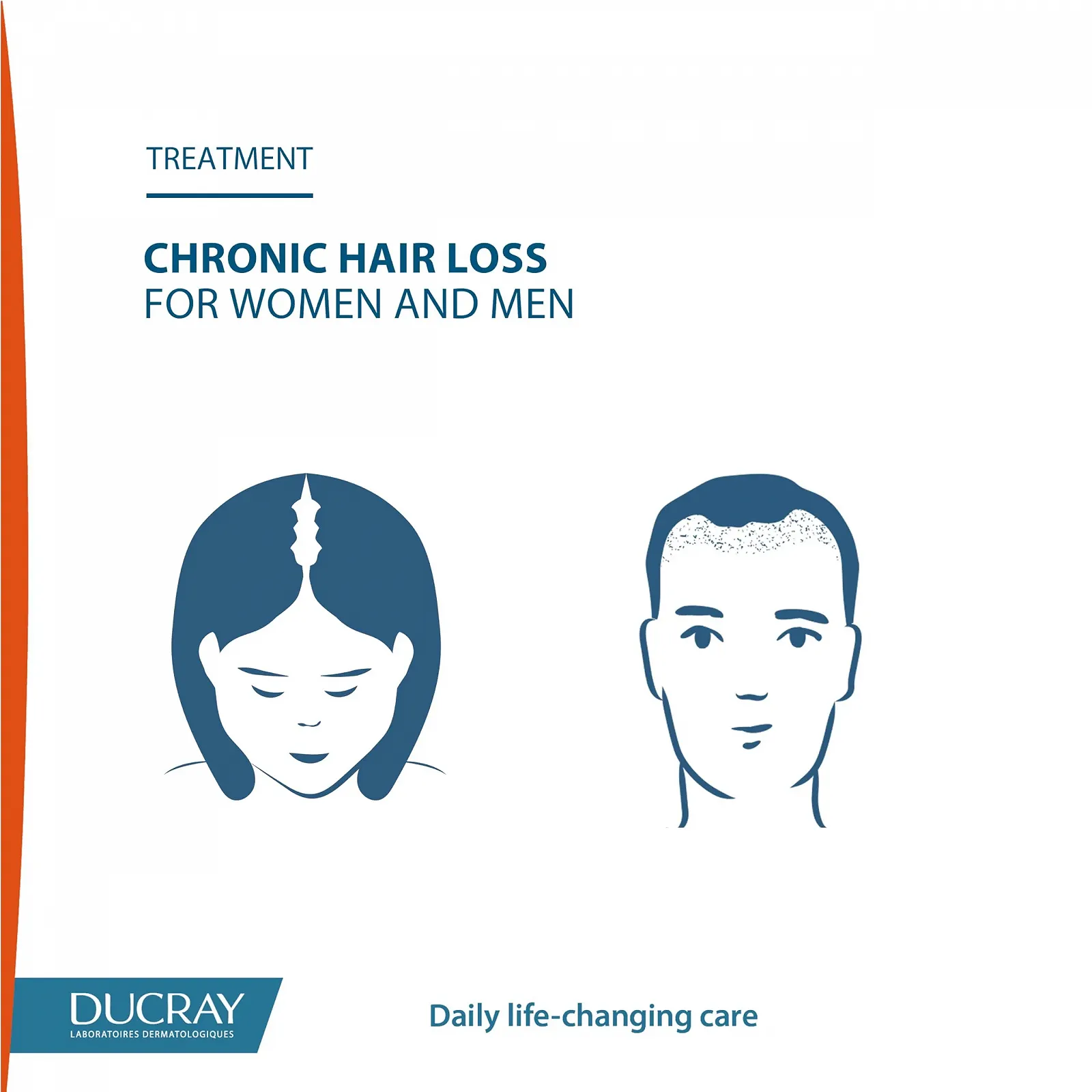 Сироватка Ducray Neoptide Expert проти випадіння волосся, фото №6