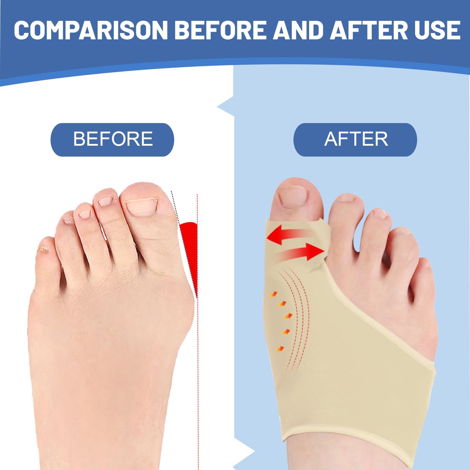Шкарпетки для корекції великого пальця стопи Hallux Valgus, корекція молоткоподібного пальця та захист, фото №5