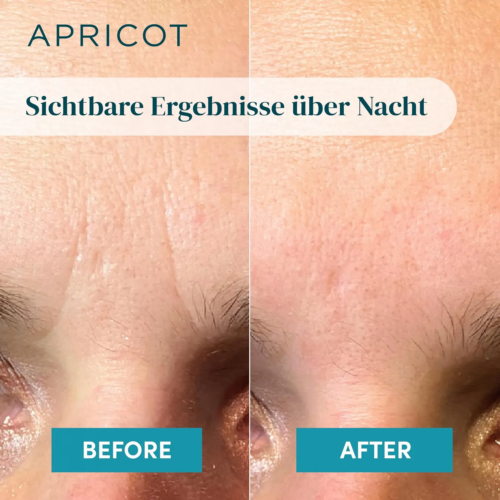 Пластыри от морщин Apricot Beauty Down the Frown, 60 шт, органический хлопок, фото №4