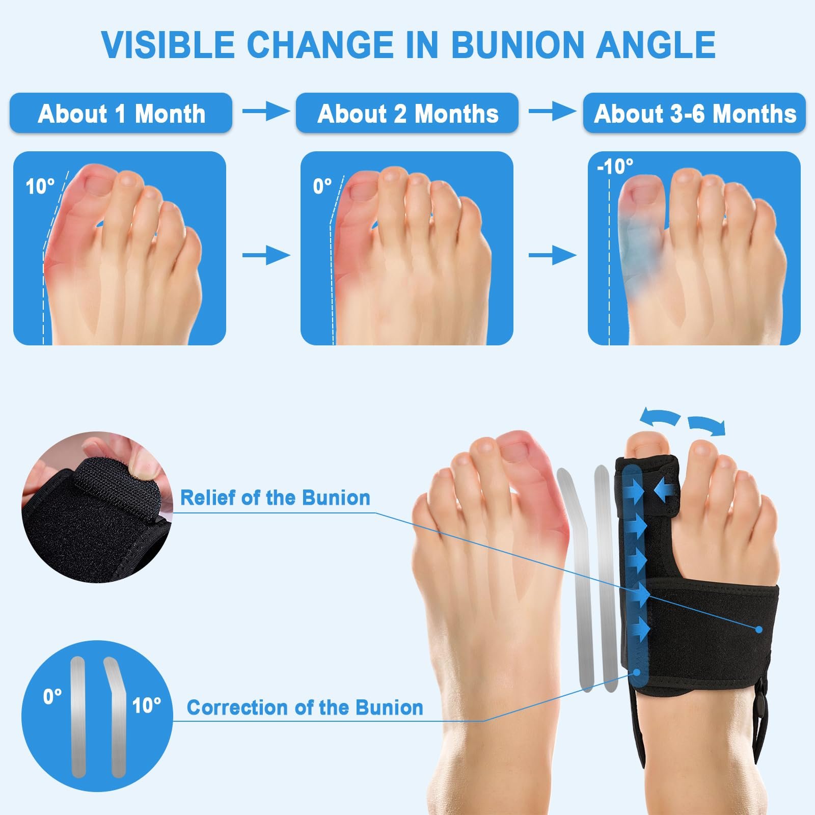 Шина для коррекции Hallux Valgus, 2 x шины для коррекции, фото №2