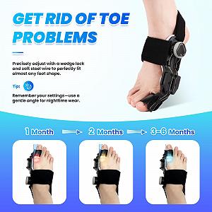 Шина для корекції Hallux Valgus з роздільником для пальців, шина Hallux Valgus з комфортною силіконовою подушечкою, регульована synthetic.ua - Фото 1