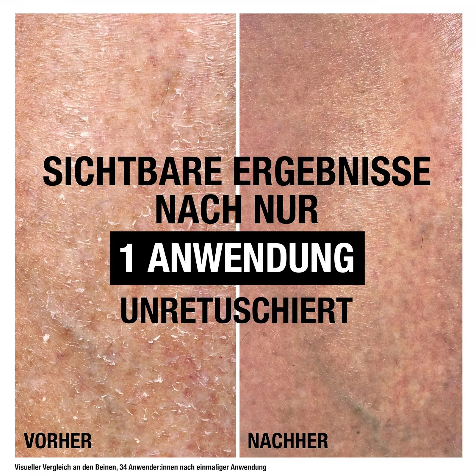 Бальзам для тела Neutrogena Norwegian Formula Intense Repair Repairing CICA 250 мл для мгновенного облегчения и большего увлажнения для очень сухой, шершавой кожи, фото №3