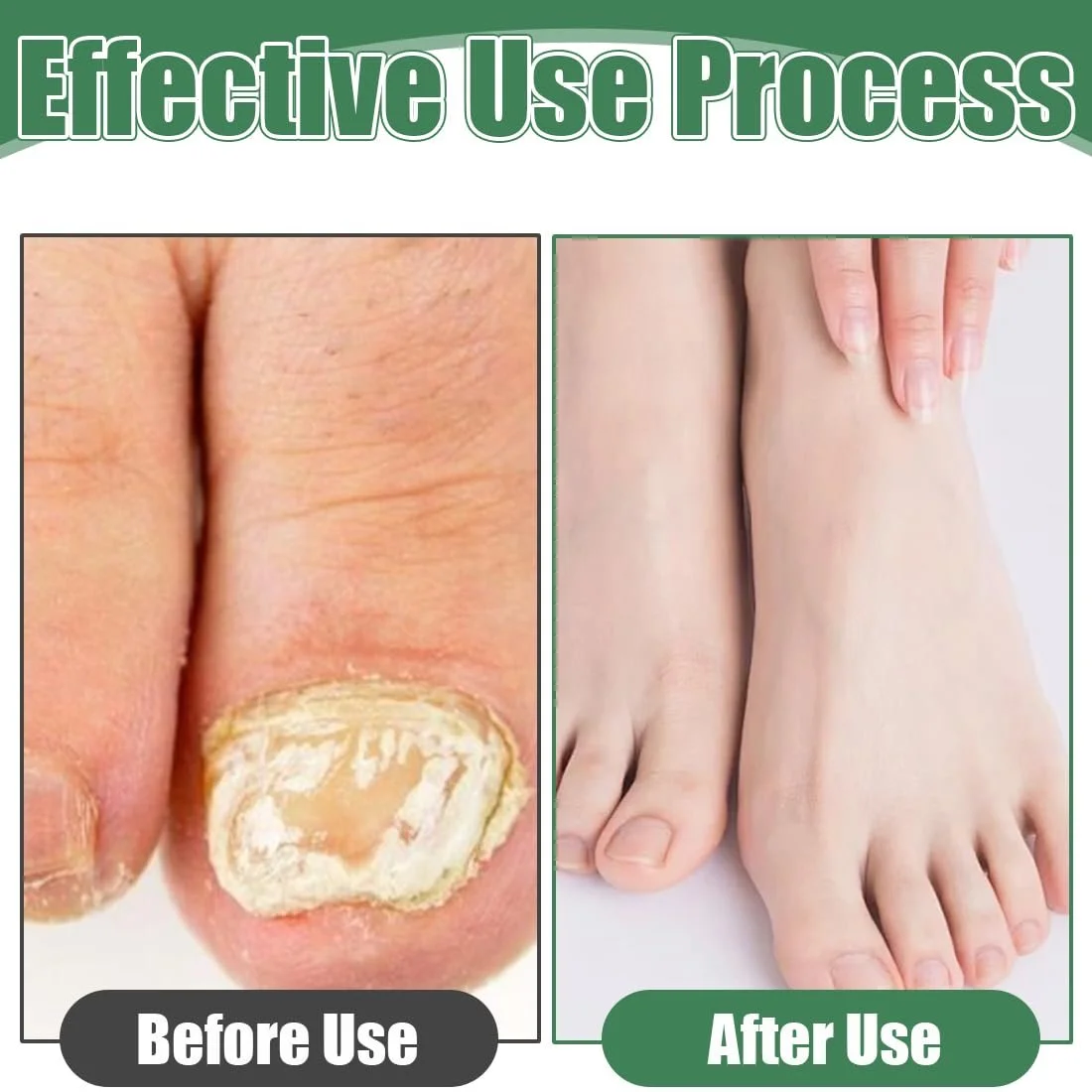 Многофункциональный гель для восстановления ногтей, Гель для лечения ногтей, Крем для ногтей (2 шт.), фото №4