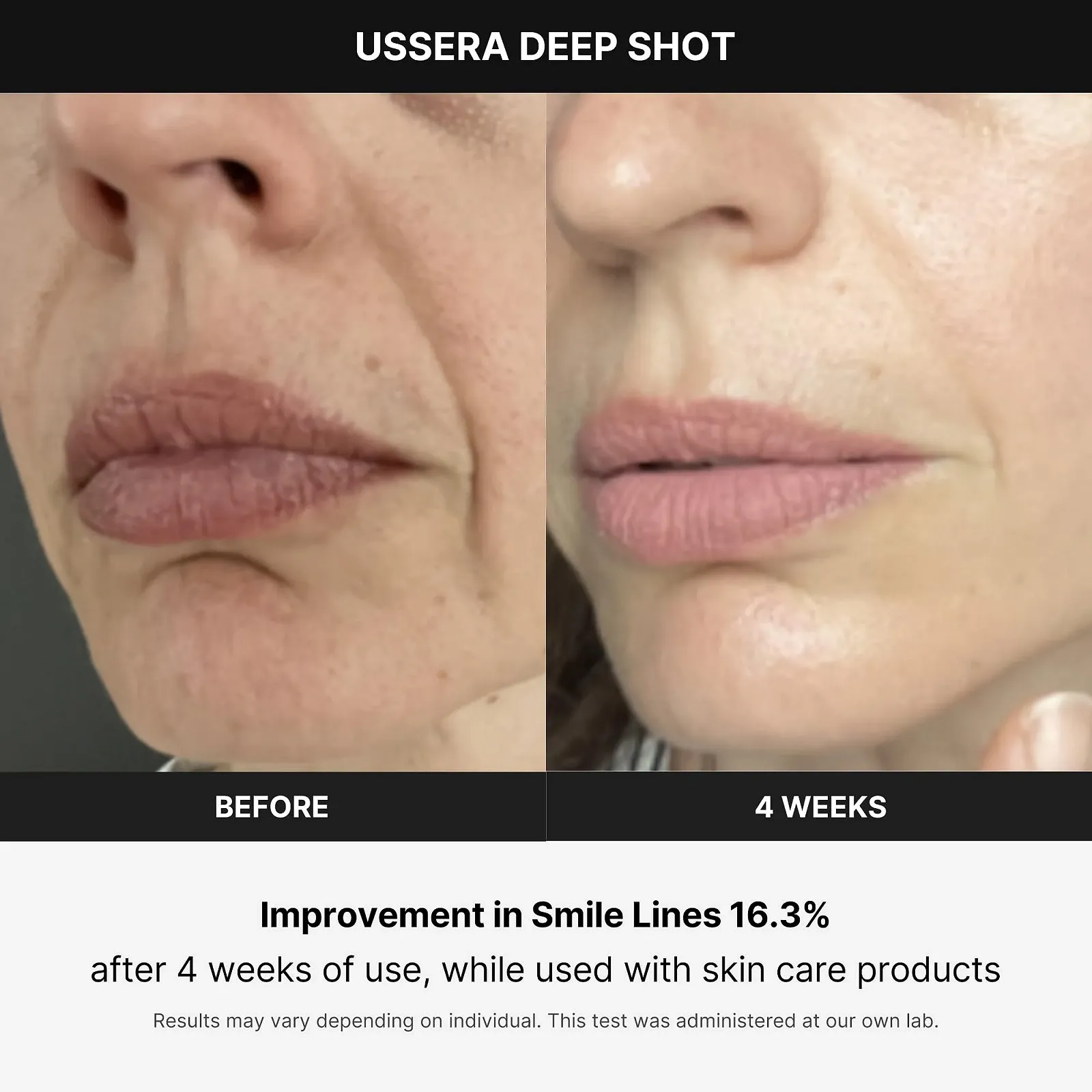 Прилад для догляду за обличчям Medicube Age-R USSERA Deep Shot Korean Skin Care, фото №3
