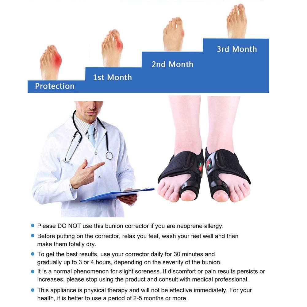 Коректор великого пальця стопи Keenso Hallux Valgus, регульований, 1 пара, для полегшення болю в стопі, фото №8