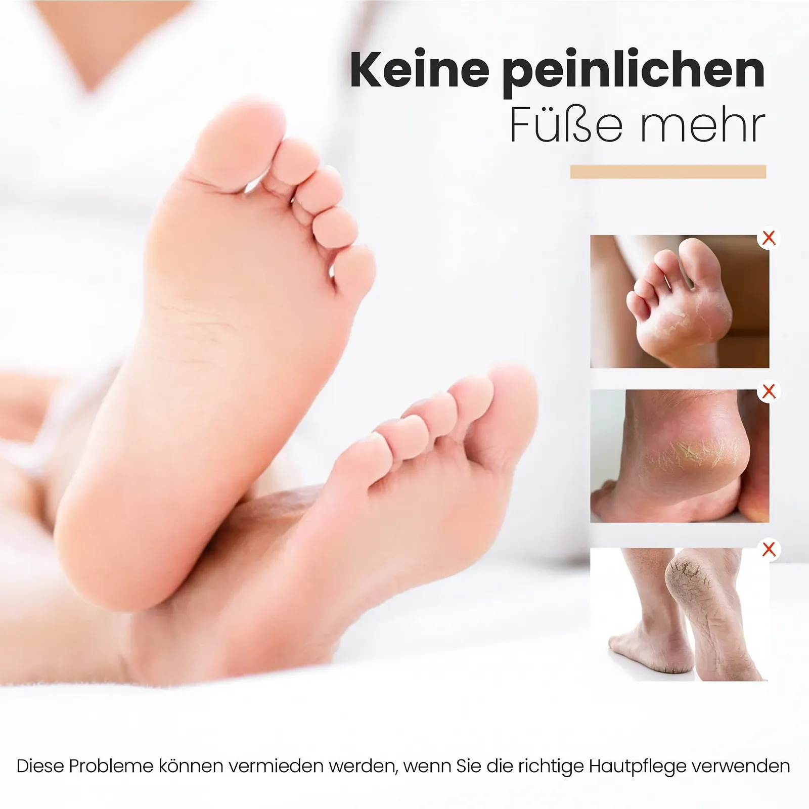 Крем для ног THE ORIGINAL Exfoliating 30% Urea на основе персикового масла и ланолина 250 мл, фото №6 Крем для ног THE ORIGINAL Exfoliating 30% Urea на основе персикового масла и ланолина 250 мл, фото №6