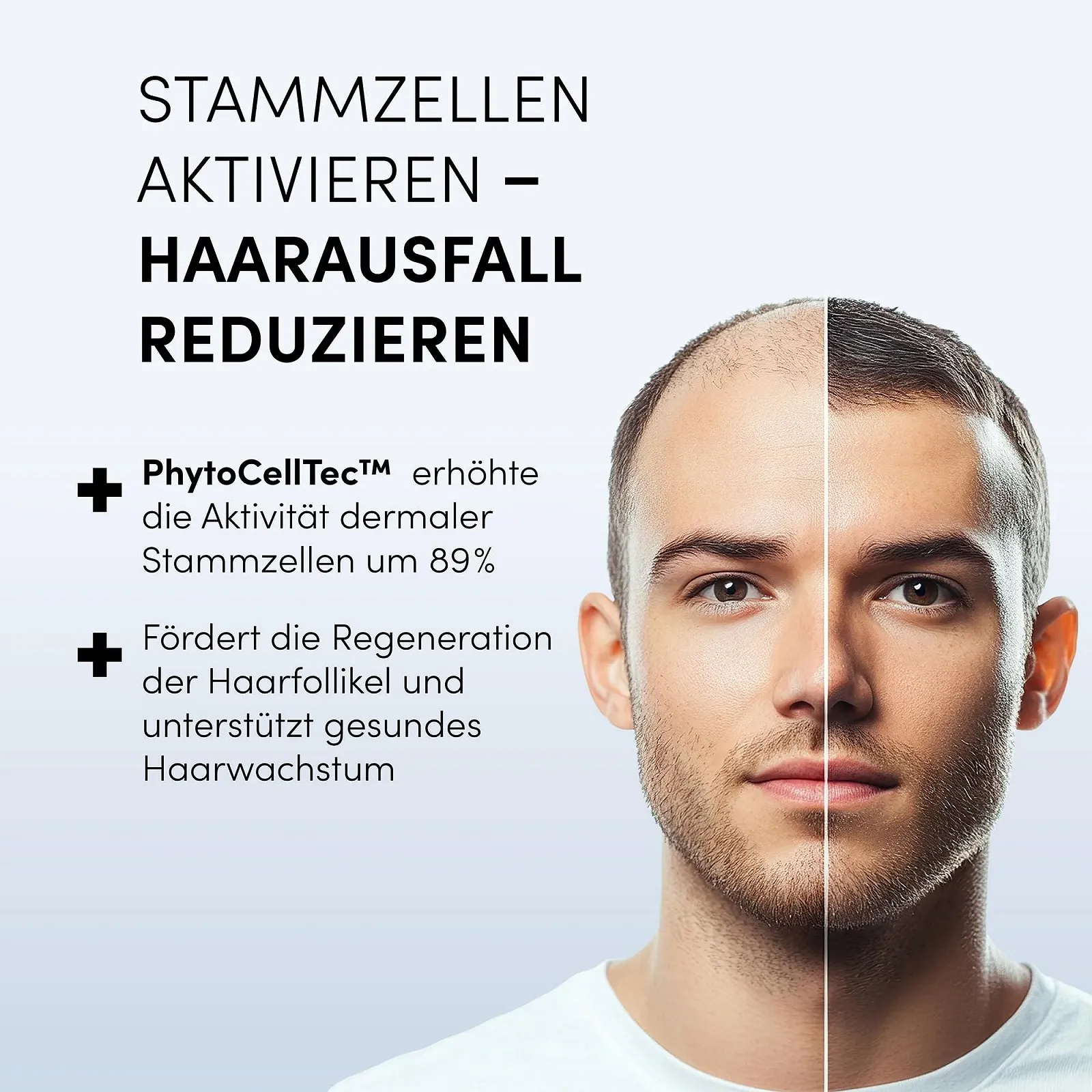 Сироватка проти випадіння волосся Dr. Balwi з Procapil& AnaGain, зміцнює коріння волосся, стимулює ріст волосся, 5 флаконів по 6 мл, фото №2