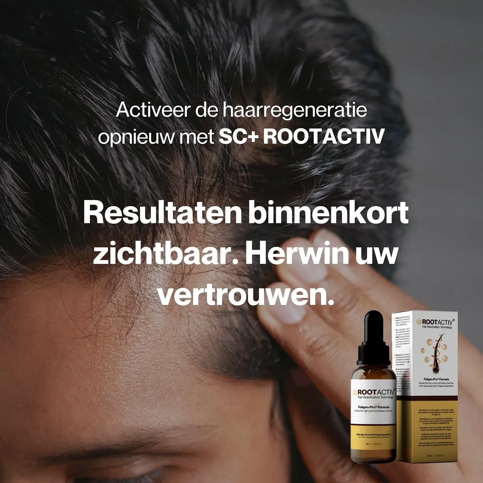 Сироватка для росту волосся зі стовбуровими клітинами SC+ ROOTACTIV для жінок та чоловіків, 75 мл, фото №8