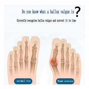 Шина для большого пальца ноги от вальгусной деформации synthetic.ua - Фото 1