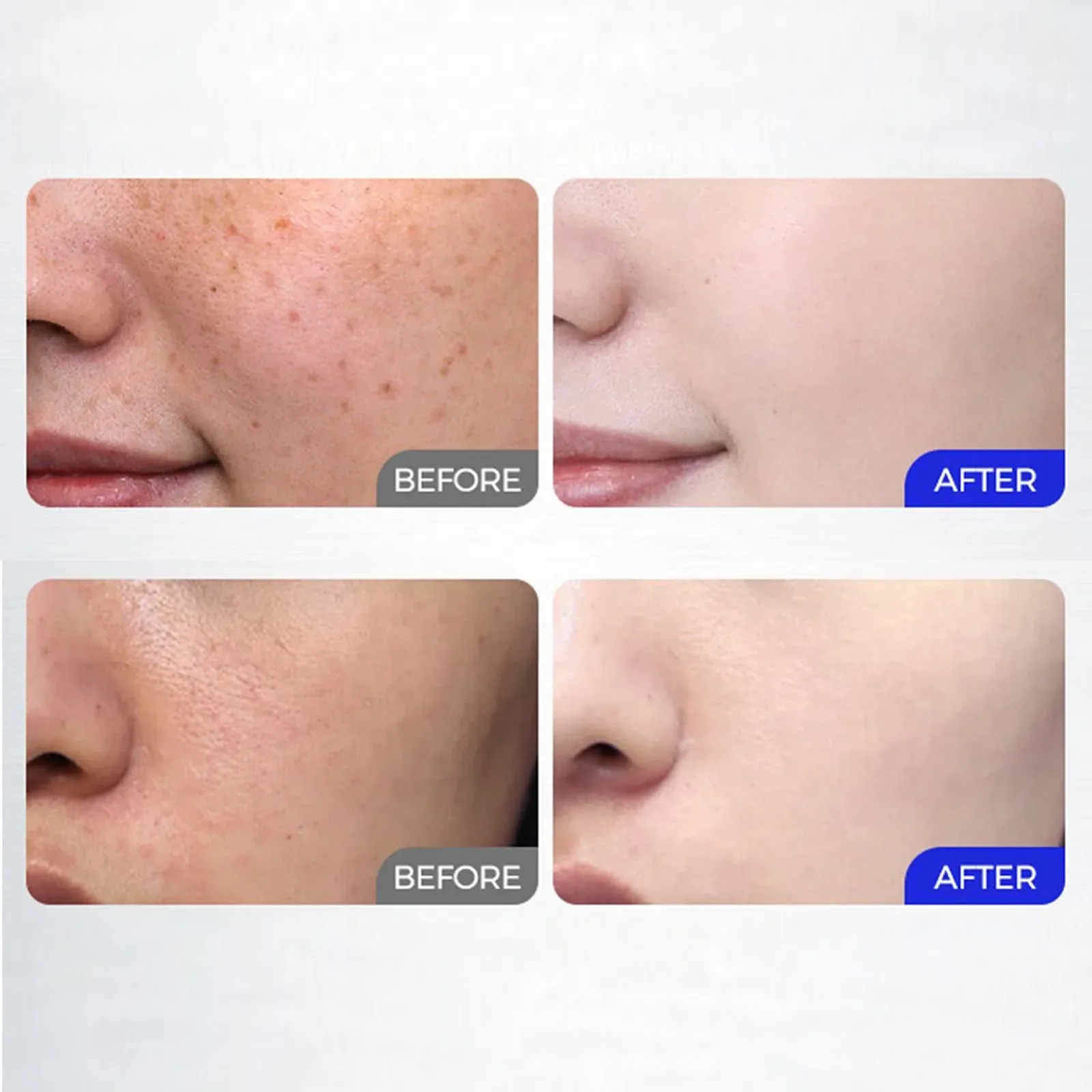 Лосьйон для тіла для освітлення шкіри 100 мл, лосьйон для обличчя для відбілювання шкіри, фото №5 Лосьйон для тіла для освітлення шкіри 100 мл, лосьйон для обличчя для відбілювання шкіри, фото №5