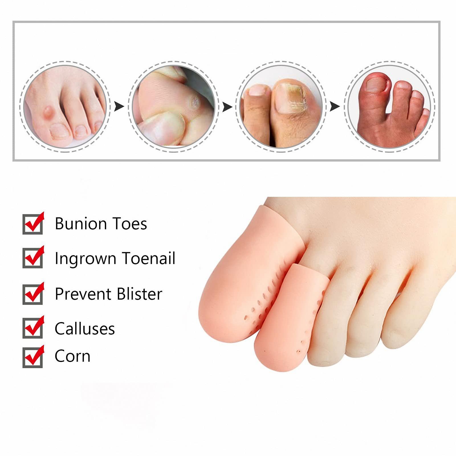 Ковпачки для пальців ніг Силіконові 8 пар Для врослих нігтів, фото №3