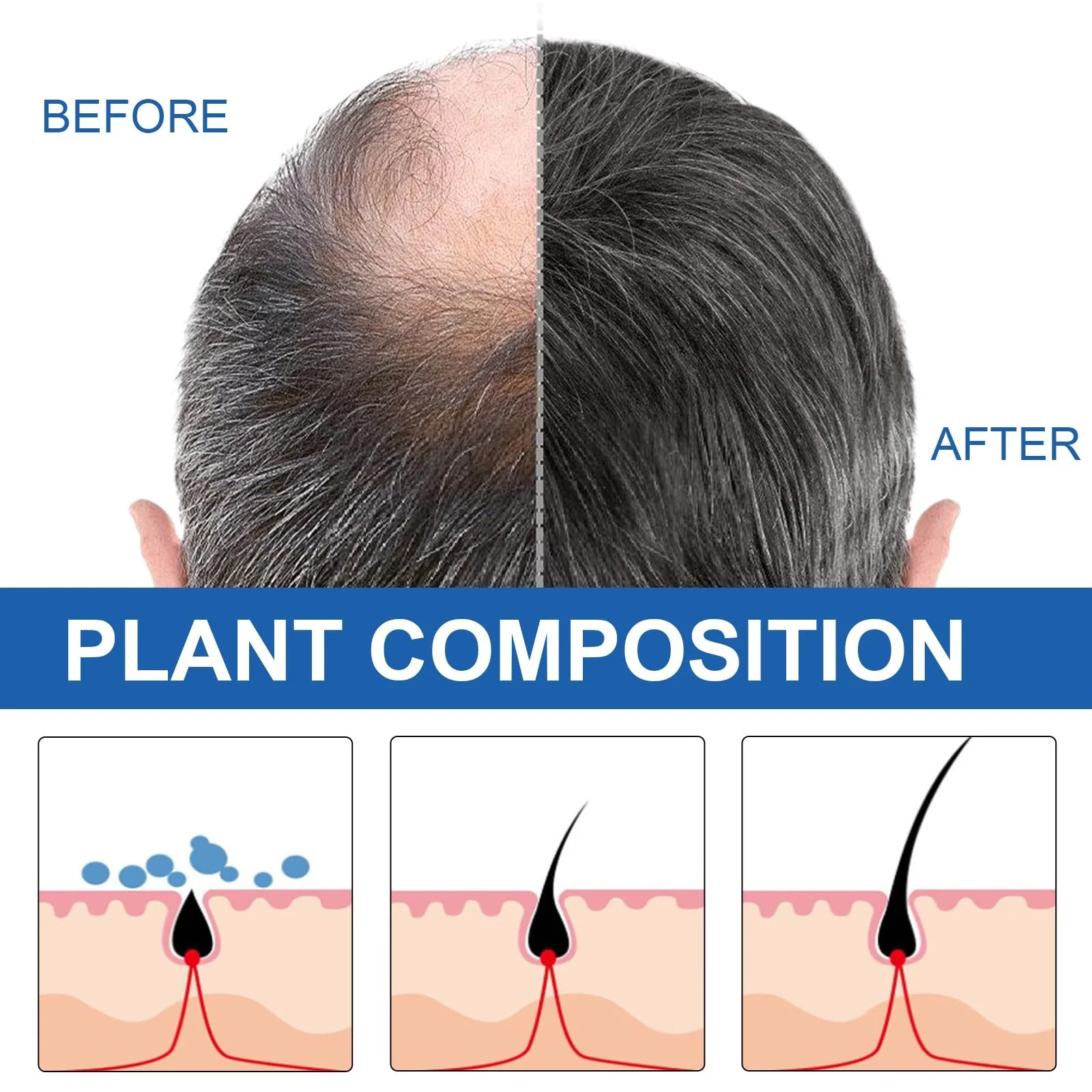 Засіб для росту волосся Натуральний 60 мл для чоловіків і жінок, фото №2