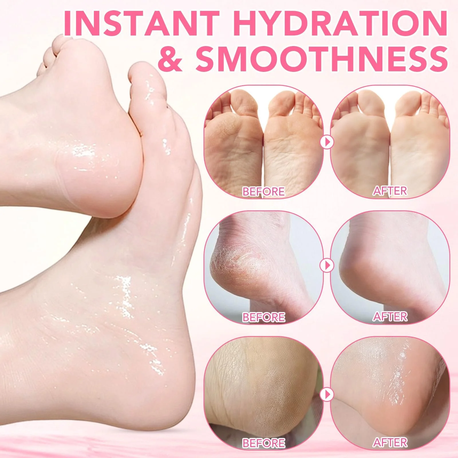 Карандаш-стик для пяток Urea 60% с 2% салициловой кислотой для сухой кожи Персик 40 г, фото №8