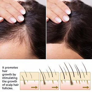 Спрей для роста волос с экстрактом имбиря и биотином, 2 шт. Сыворотка для роста волос, укрепляет корни волос, уменьшает выпадение волос, для более густых и длинных волос, восстановление ломких волос synthetic.ua - Фото 1