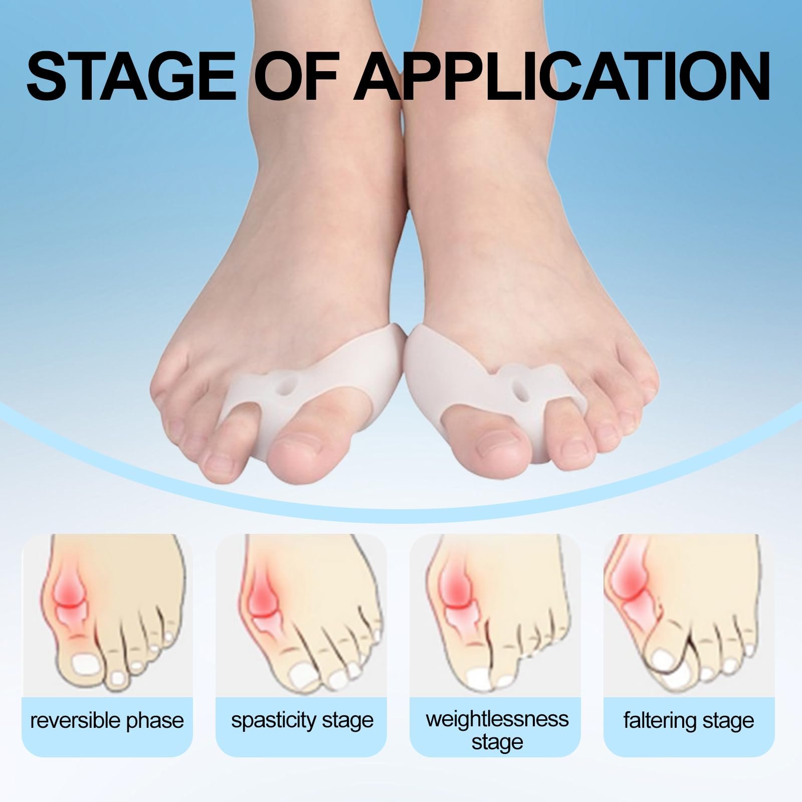 Пов'язка для корекції Hallux Valgus, Денна та нічна шина для чоловіків та жінок, фото №5