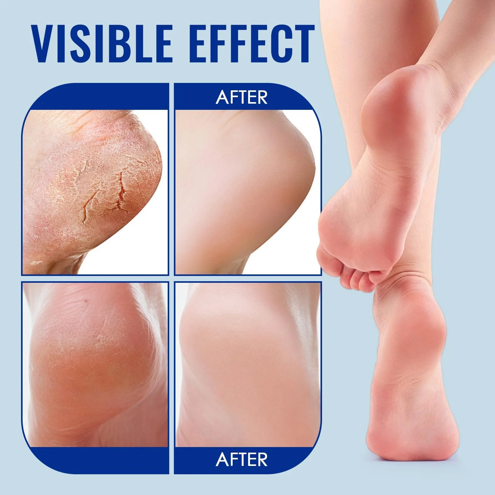 Набор кремов для рук и ног Urea Cream 40% от трещин и мозолей 2 шт по 30 г, фото №6