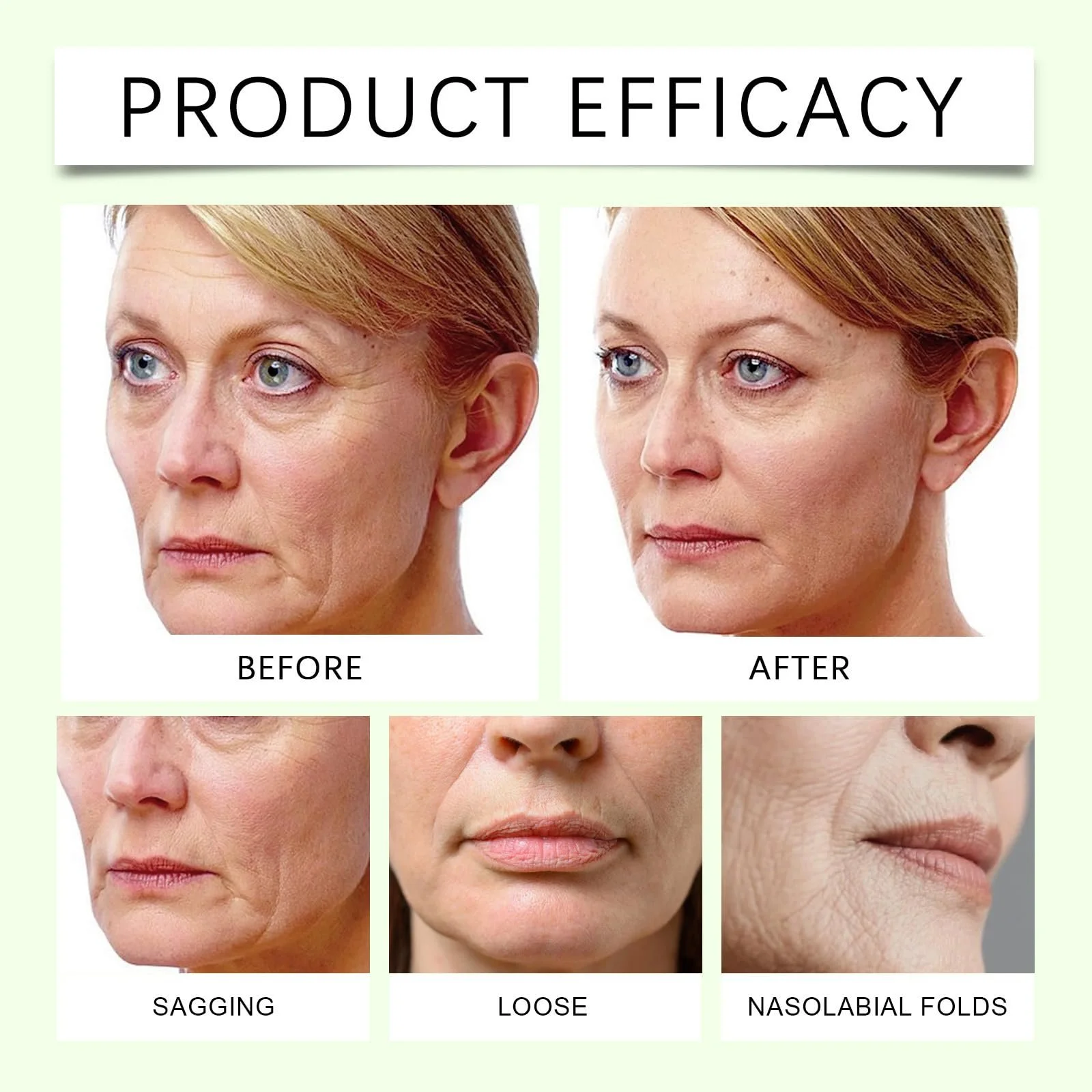 Силиконовые патчи для лица против старения, фото №3