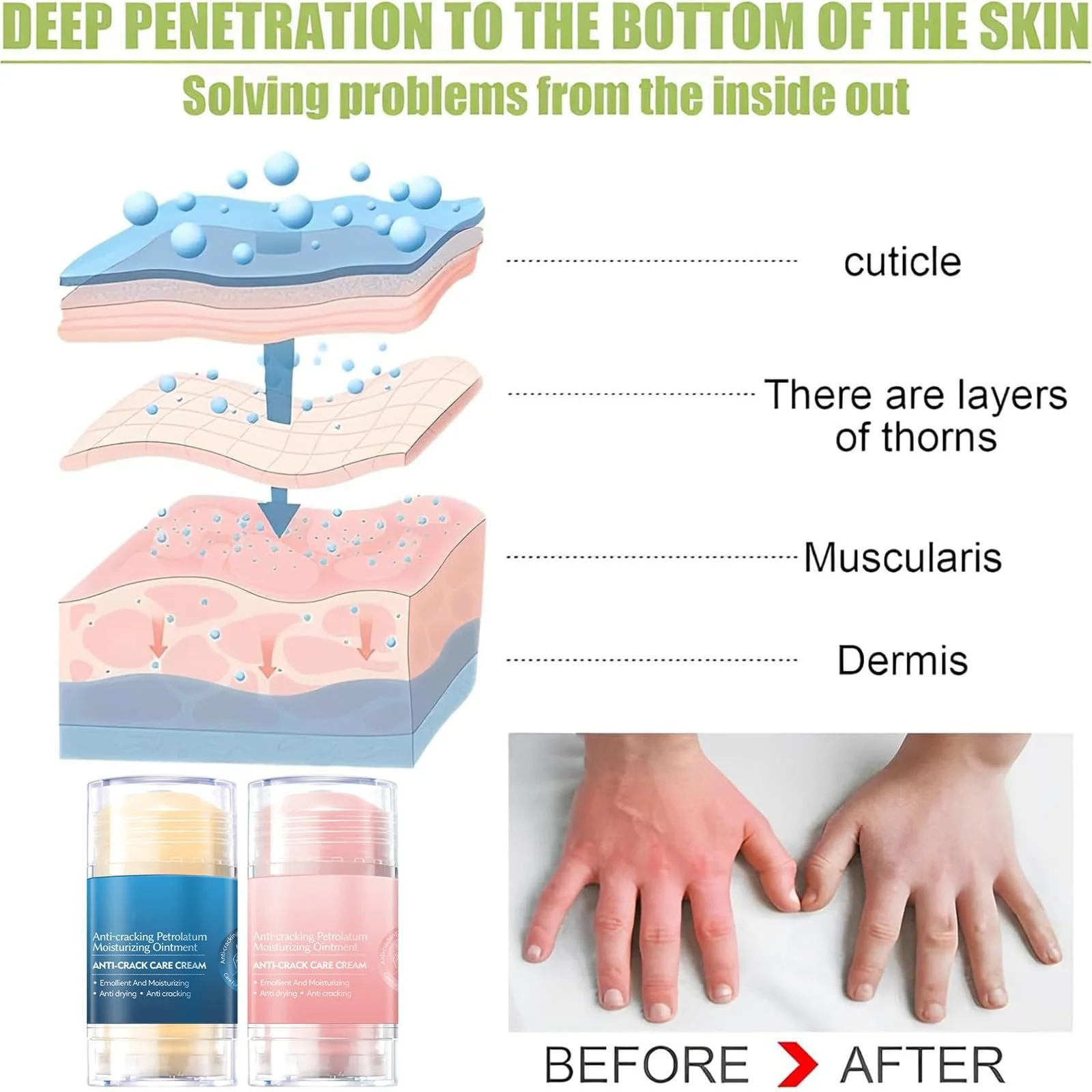 Крем для восстановления кожи HOUSN Cracked Skin Repair Cream с 60% мочевины для рук и ног 2 шт., фото №7