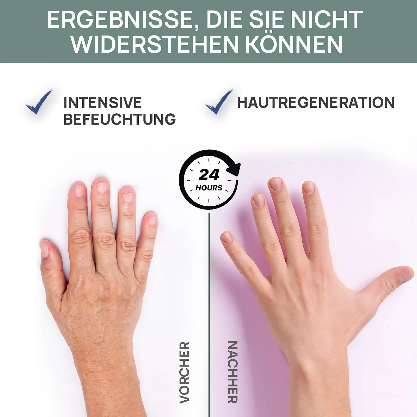 Крем для рук та нігтів Vis Plantis з слизом равлика, оливковою олією та сечовиною 135 мл, фото №2 Крем для рук та нігтів Vis Plantis з слизом равлика, оливковою олією та сечовиною 135 мл, фото №2