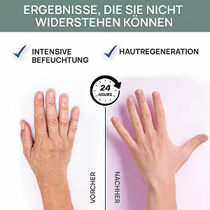 Крем для рук та нігтів Vis Plantis з слизом равлика, оливковою олією та сечовиною 135 мл synthetic.ua - Фото 1