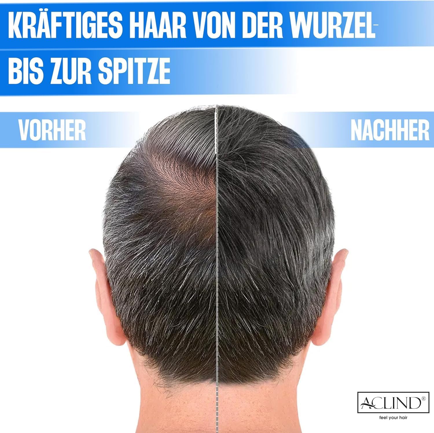 Шампунь ACLIND Проти випадіння волосся Органічні інгредієнти 300 мл, фото №4 Шампунь ACLIND Проти випадіння волосся Органічні інгредієнти 300 мл, фото №4