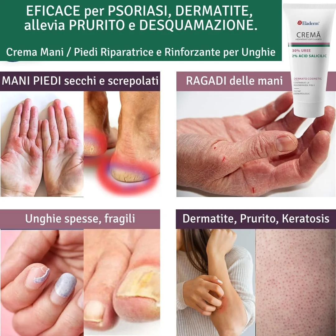 Крем для ног Eladerm с мочевиной 30% 100 мл, фото №4 Крем для ног Eladerm с мочевиной 30% 100 мл, фото №4