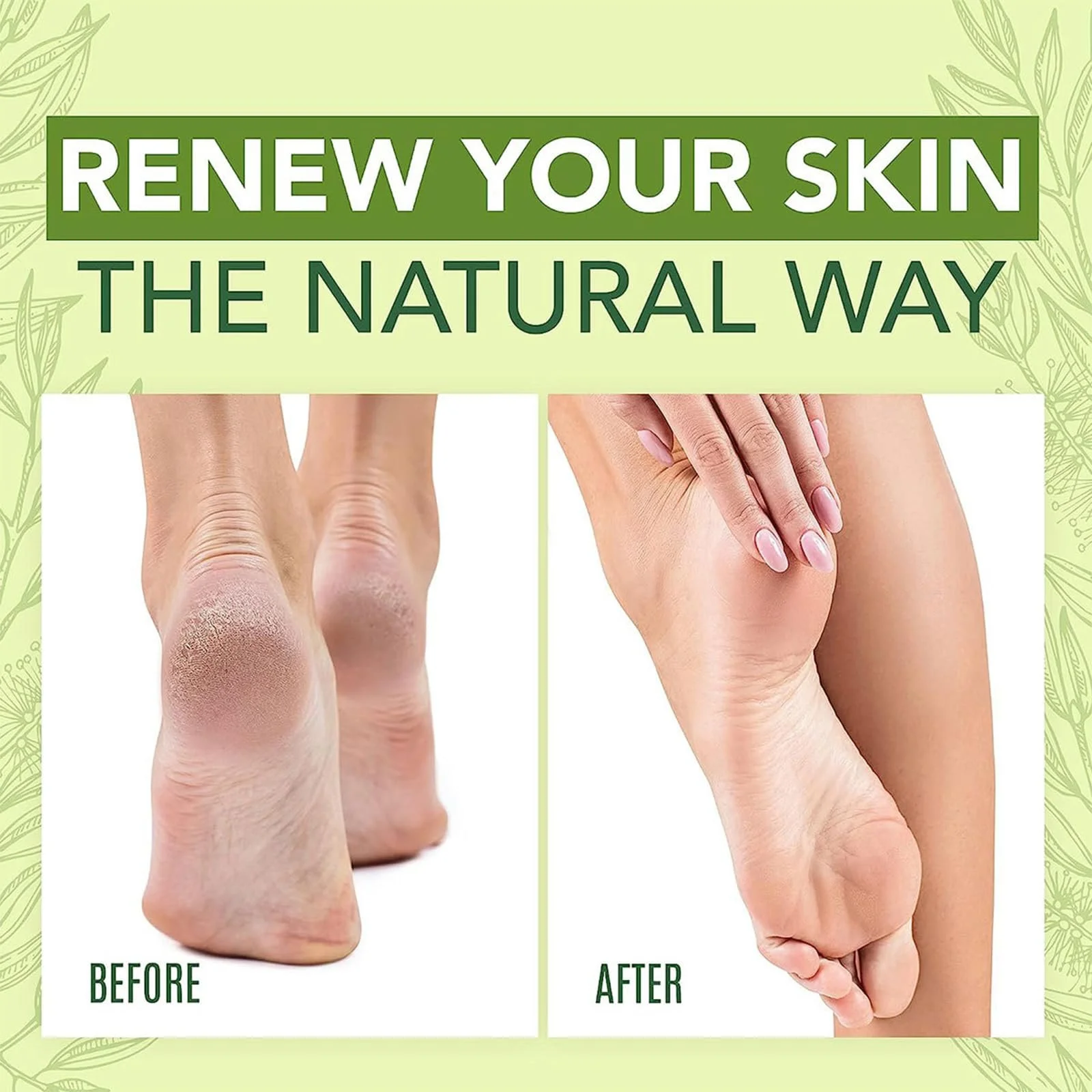 Крем для ног Shentiru увлажняющий против трещин и мозолей, фото №2 Крем для ног Shentiru увлажняющий против трещин и мозолей, фото №2