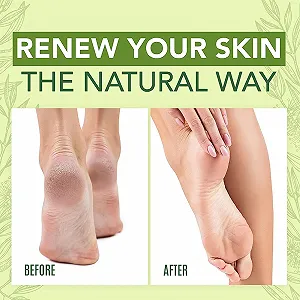 Крем для ног Shentiru увлажняющий против трещин и мозолей synthetic.ua - Фото 1