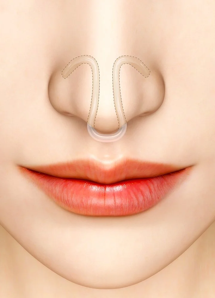 Роздільник для носа CLIPAIR Розмір L, фото №2